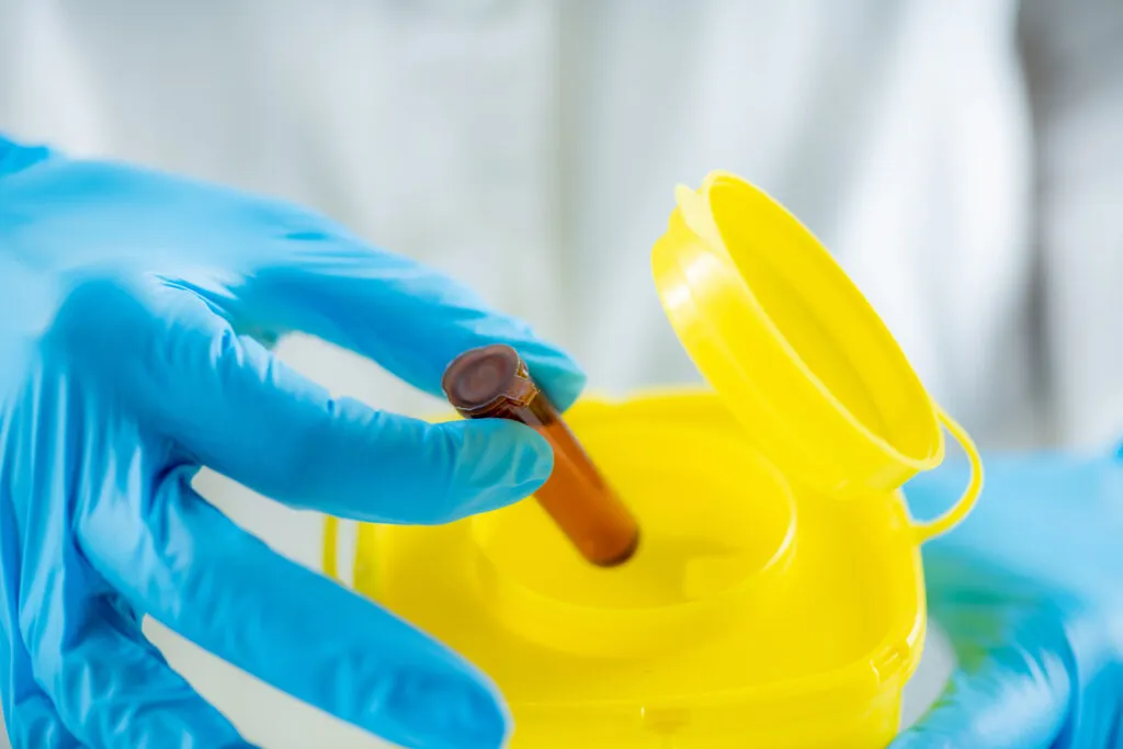 Entsorgung der Buttersäure