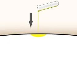 Katzenurin läuft auf das Polster