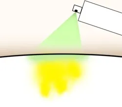 Bio Urin Attacke Katzenurin-Entferner wird auf den Katzenurinfleck im Polster gesprüht.